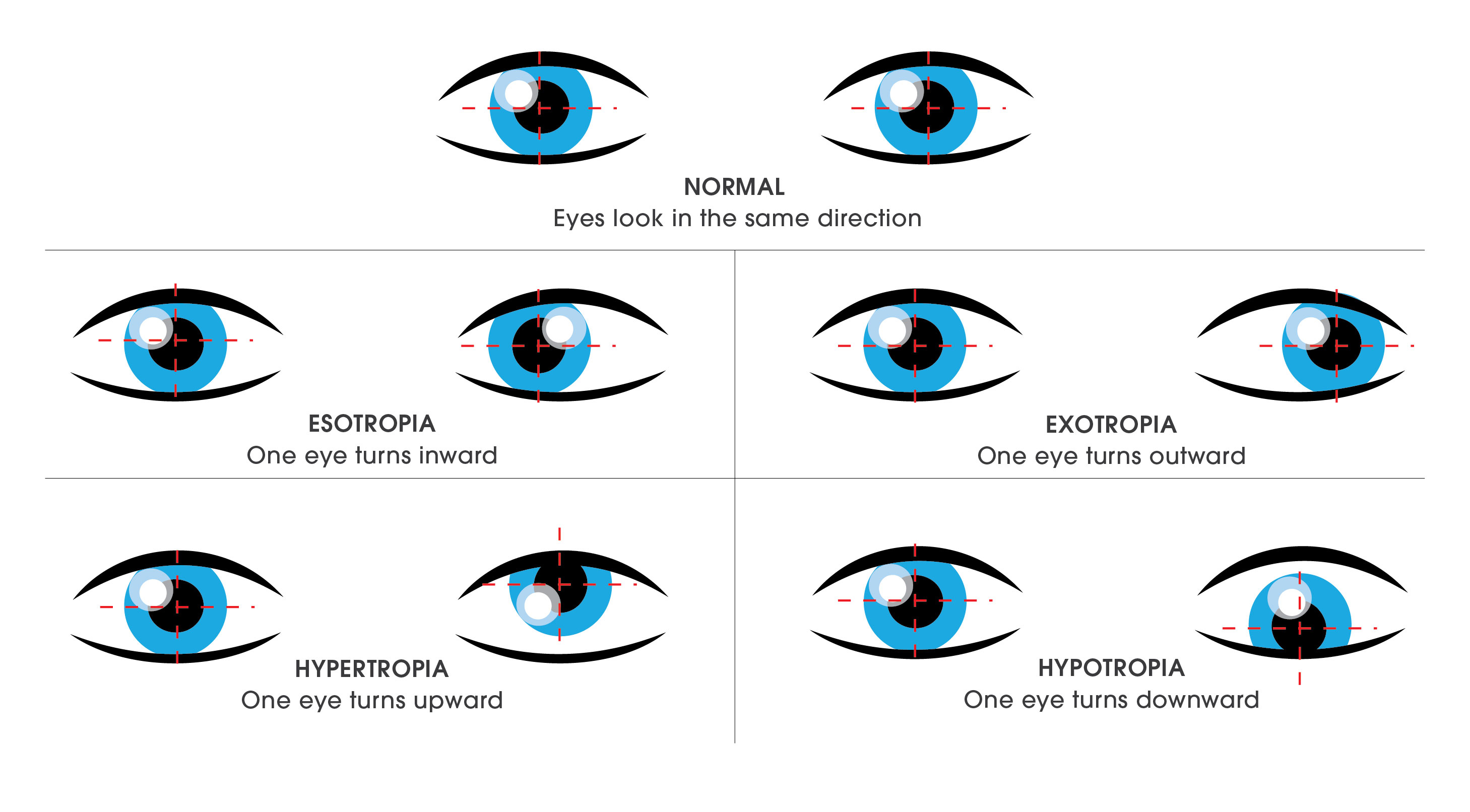 Toddler Eye Exam Chart